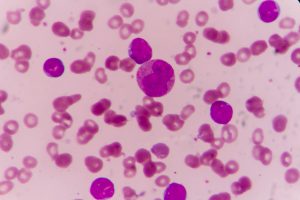 Blood smear