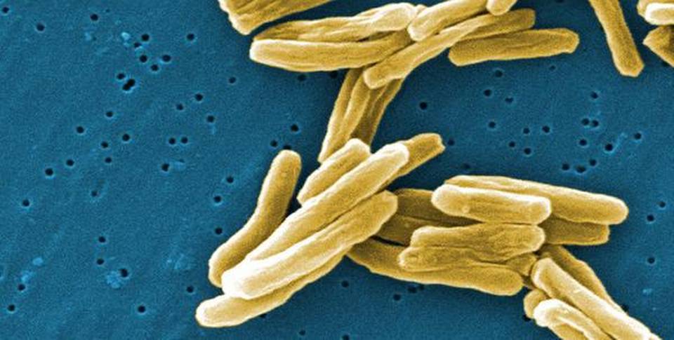 Diagnosis of drug-resistant TB
